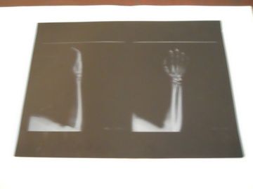 Película seca médica de la proyección de imagen de la niebla baja de KND-A para el examen de X Ray en el × el 14in de AGFA 5300 el 11in